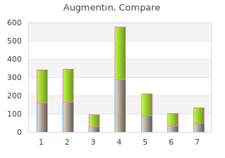generic augmentin 625mg online