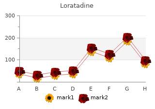 discount 10 mg loratadine amex
