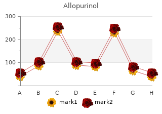 safe allopurinol 300mg