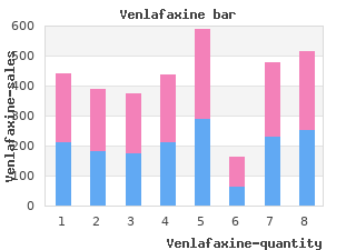 cheap 75mg venlafaxine amex