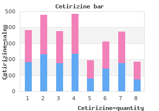 generic cetirizine 10 mg mastercard