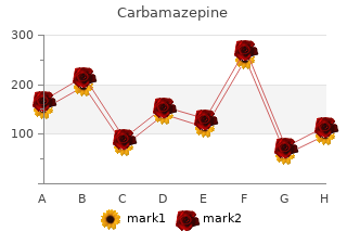 generic 400 mg carbamazepine with amex